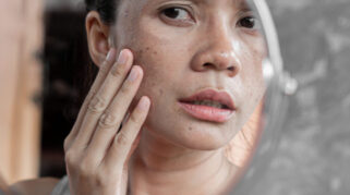 Apa Itu Skin Barrier dan Cara Memperbaikinya