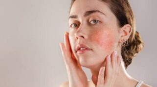 Cara Memakai Serum Vitamin C untuk Kulit Sensitif